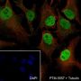 Anti-SMARCD3 Rabbit mAb