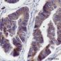 Anti-Bcl-G Mouse mAb