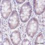 Anti-alpha Actinin 4 Rabbit mAb