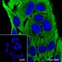 Anti-alpha Actinin 4 Rabbit mAb