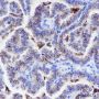 Anti-Napsin A Rabbit mAb