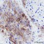 Anti-TROP2 Rabbit mAb