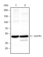 Anti-ASGR1 Rabbit mAb