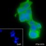 Anti-ASGR1 Rabbit mAb