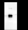 Anti-ASGR1 Rabbit mAb