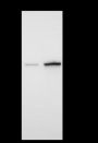 Anti-AMACR Rabbit mAb