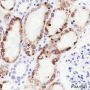 Anti-AMACR Rabbit mAb