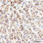 Anti-AMACR Rabbit mAb