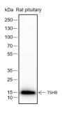 Anti-TSHB Rabbit mAb