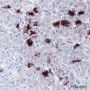 Anti-TSHB Rabbit mAb