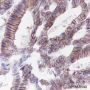 Anti-Cadherin-17 Rabbit mAb