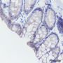 Anti-Cadherin-17 Rabbit mAb
