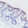 Anti-Cadherin-17 Rabbit mAb