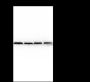 Anti-ATPB Mouse mAb
