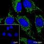 Anti-ATPB Mouse mAb
