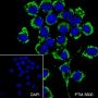 Anti-ATPB Mouse mAb