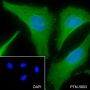 Anti-LOX Rabbit mAb