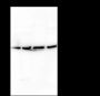 Anti-Laminin Receptor / RPSA Rabbit mAb
