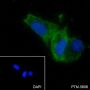 Anti-ATG4B Rabbit mAb