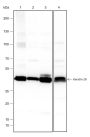 Anti-Keratin 20 Rabbit mAb