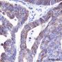 Anti-Keratin 20 Rabbit mAb