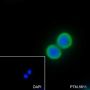 Anti-Keratin 20 Rabbit mAb