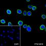 Anti-Cystatin A Rabbit mAb