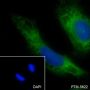 Anti-ABCE1 Rabbit mAb