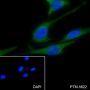 Anti-ABCE1 Rabbit mAb