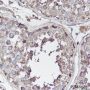 Anti-p130Cas/BCAR1 Mouse mAb