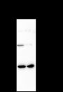 Anti-14-3-3 sigma Mouse mAb