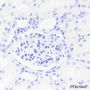 Anti-CD23 Rabbit mAb