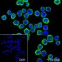 Anti-CD23 Rabbit mAb