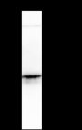 Anti-Keratin 19 Rabbit mAb