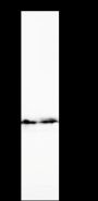 Anti-Keratin 19 Rabbit mAb