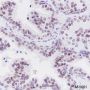Anti-TFEB Rabbit mAb