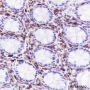 Anti-CD38 Rabbit mAb