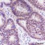 Anti-FOXP1 Rabbit mAb