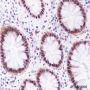 Anti-FOXP1 Rabbit mAb