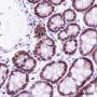 Anti-FOXP1 Rabbit mAb