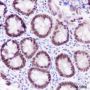 Anti-FOXP1 Rabbit mAb