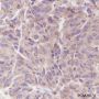 Anti-PI3 Kinase p85 alpha Rabbit mAb