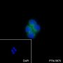 Anti-PI3 Kinase p85 alpha Rabbit mAb
