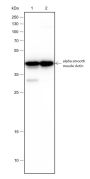 Anti-alpha Smooth Muscle Actin Rabbit mAb