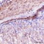 Anti-alpha Smooth Muscle Actin Rabbit mAb