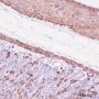 Anti-alpha Smooth Muscle Actin Rabbit mAb