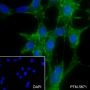 Anti-alpha Smooth Muscle Actin Rabbit mAb