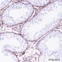 Anti-DPEP1 Rabbit mAb