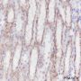 Anti-GOT1 Rabbit mAb