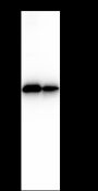 Anti-CRALBP Rabbit mAb